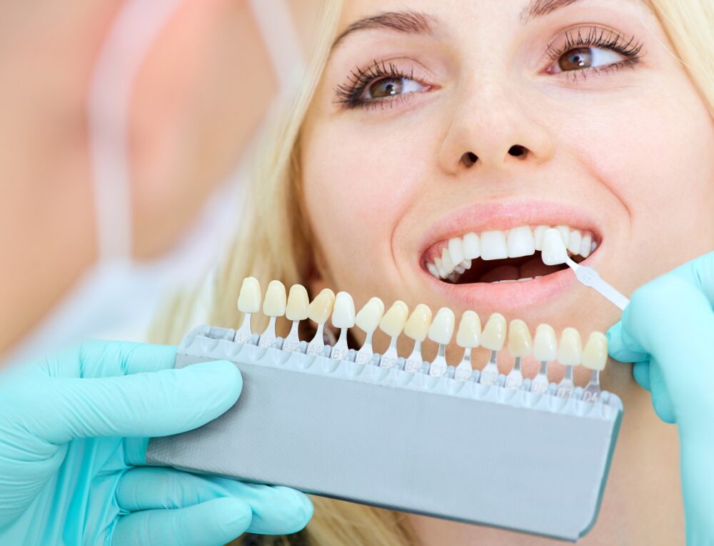 Lentes de Contato Dental Montreal Odontologia Taguatinga Norte